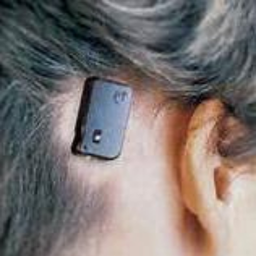 Bone conduction hearing device BAHA